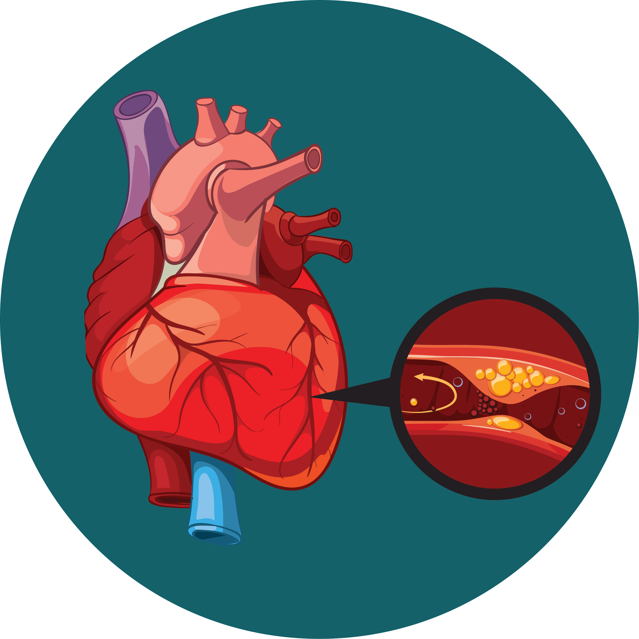 Lisinopril and the Cough That Launched a Thousand Google Searches